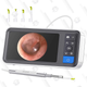 Digital Otoscope | $60 | Amazon